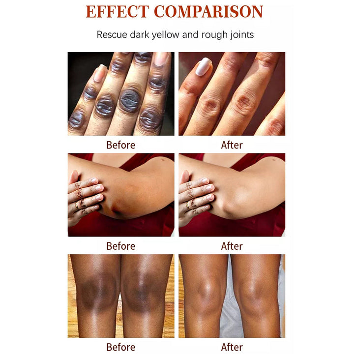 Removedor de manchas oscuras de espinillas de acné de vitamina C facial de cuello vegano natural coreano